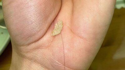 Isparta’da Ekmekte Saç Teli: Hijyen Alarmı